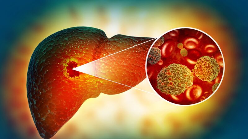 Potential fatty liver treatment may increase risk of cancer